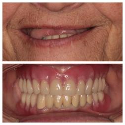 Prima e dopo il lavoro dentale